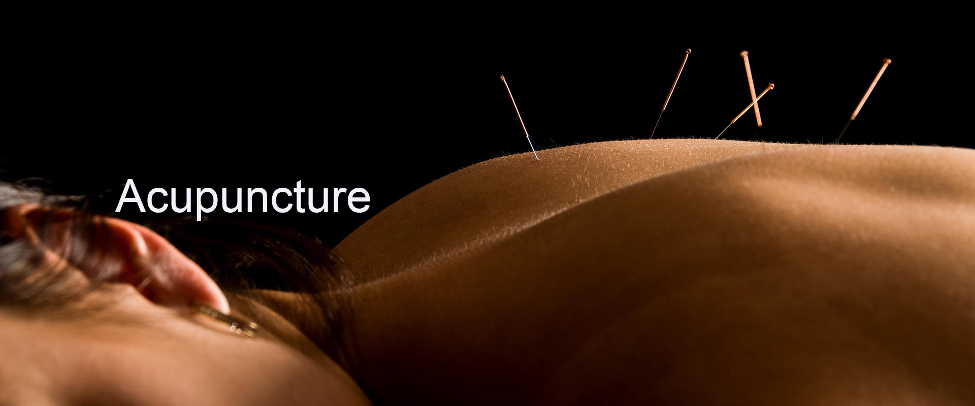 bilboard-bonus-acupuncture
